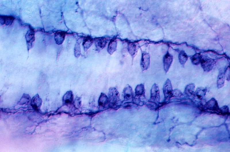 Zebrafish embryo neurons, fluorescence microscopy